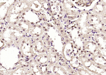 ZFP36L1 Rabbit Polyclonal Antibody