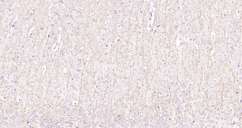 Rat MBP Ready-To-Use IHC Kit