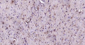 Human GFAP Ready-To-Use IHC Kit