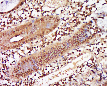 ZNF740 Rabbit Polyclonal Antibody