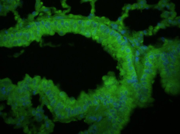 SFTPC Rabbit Polyclonal Antibody (BF488)