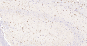 GFAP Ready-To-Use IHC Kit