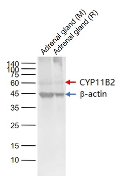 CYP11B2 Rabbit Polyclonal Antibody