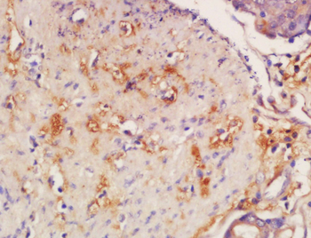 CYP11B2 Rabbit Polyclonal Antibody