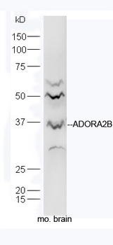 ADORA2B Rabbit Polyclonal Antibody