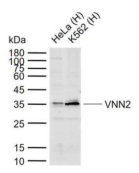 VNN2 Rabbit Polyclonal Antibody