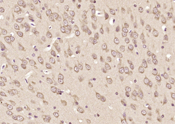 Gemin 6 Rabbit Polyclonal Antibody
