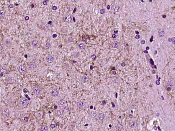 CDH12 Rabbit Polyclonal Antibody