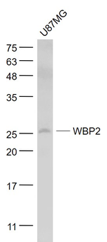 WBP2 Rabbit Polyclonal Antibody