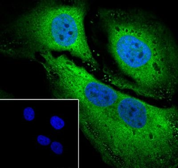 STIP1 Recombinant Rabbit Monoclonal Antibody