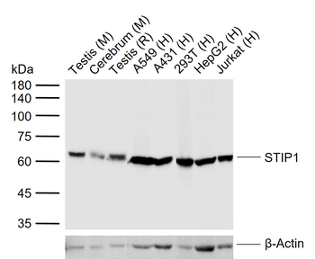 STIP1 Recombinant Rabbit Monoclonal Antibody