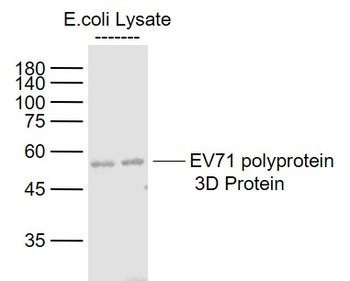 EV71 polyprotein 3D Rabbit Polyclonal Antibody