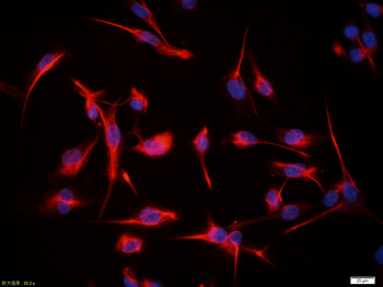 Vimentin Rabbit Polyclonal Antibody (BF594)