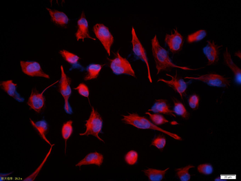 Vimentin Rabbit Polyclonal Antibody (BF594)