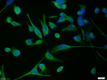 Vimentin Rabbit Polyclonal Antibody (BF488)