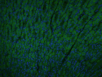 Calreticulin Rabbit Polyclonal Antibody (BF488)