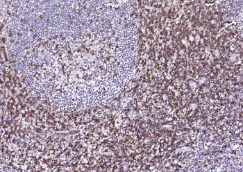 CD5 Mouse Monoclonal Antibody
