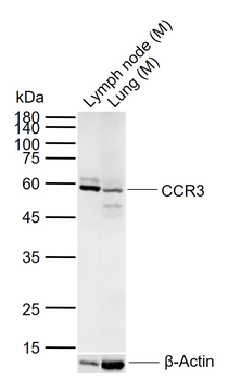 CCR3 Rabbit Polyclonal Antibody