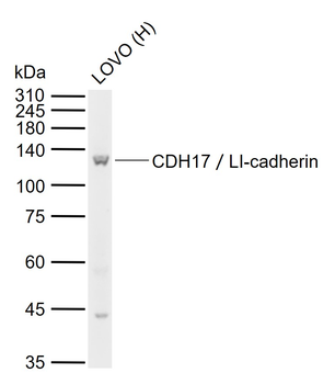 CDH17／LI-cadherin Rabbit Polyclonal Antibody