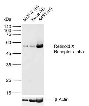 Retinoid X Receptor alpha Recombinant Rabbit Monoclonal Antibody