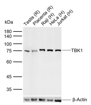 TBK1 Recombinant Rabbit Monoclonal Antibody