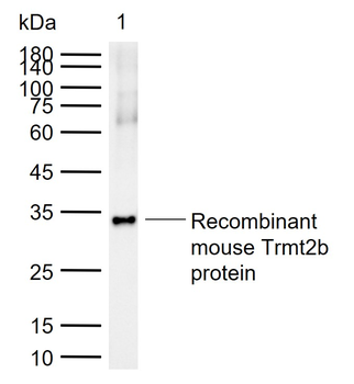 TRMT2B Rabbit Polyclonal Antibody