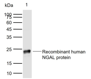 NGAL Mouse Monoclonal Antibody