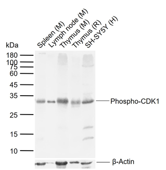 Phospho-CDK1 (Thr14) Rabbit Polyclonal Antibody