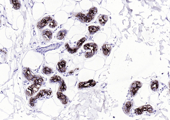 GCDFP15 Mouse Monoclonal Antibody