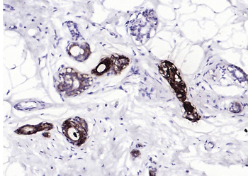 GCDFP15 Mouse Monoclonal Antibody