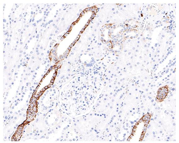 CD171/L1CAM Recombinant Rabbit Monoclonal Antibody