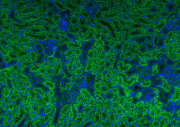ATG5/APG5L Mouse Monoclonal Antibody