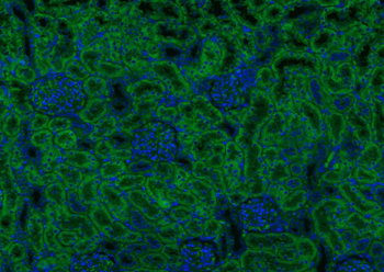 ATG5/APG5L Mouse Monoclonal Antibody