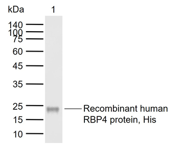RBP4 Mouse Monoclonal Antibody