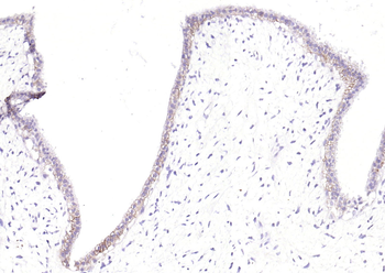 CD239 Recombinant Rabbit Monoclonal Antibody