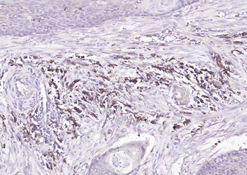 Mesothelin Rabbit Polyclonal Antibody