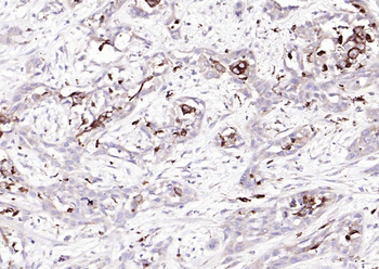 Mesothelin Rabbit Polyclonal Antibody