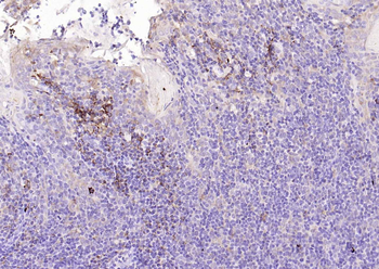 Mesothelin Rabbit Polyclonal Antibody