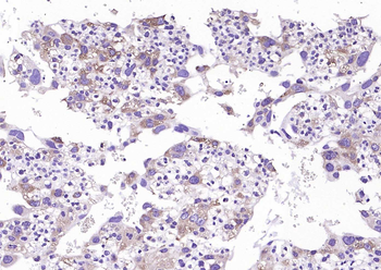 Vitamin D Binding protein Mouse Monoclonal Antibody