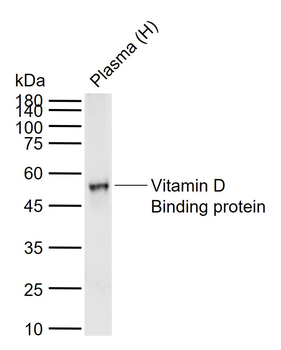 Vitamin D Binding protein Mouse Monoclonal Antibody