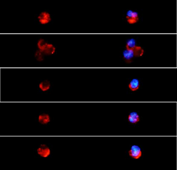 MPO Rabbit Polyclonal Antibody (BF555)
