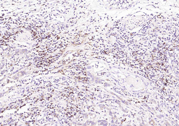 HLA-C Mouse Monoclonal Antibody