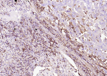 HLA-C Mouse Monoclonal Antibody
