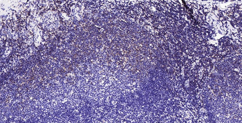 HLA-C Mouse Monoclonal Antibody