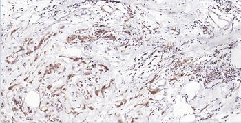 HLA-C Mouse Monoclonal Antibody