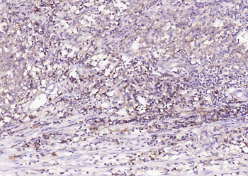 HLA-C Mouse Monoclonal Antibody