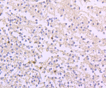Ferritin Heavy Chain Recombinant Rabbit Monoclonal Antibody
