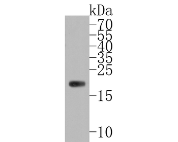 Ferritin Heavy Chain Recombinant Rabbit Monoclonal Antibody