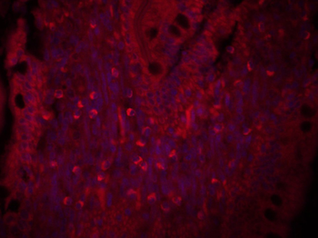 TGF beta Receptor I Rabbit Polyclonal Antibody (BF594)