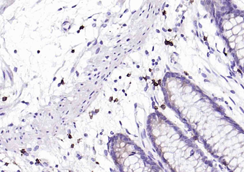 CD8 Recombinant Rabbit Monoclonal Antibody